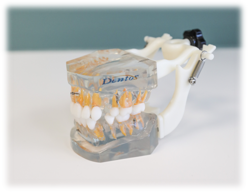 Mini-vis Orthodontiques